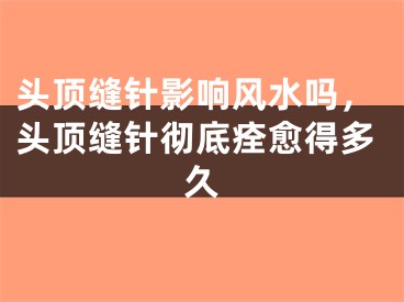头顶缝针影响风水吗，头顶缝针彻底痊愈得多久